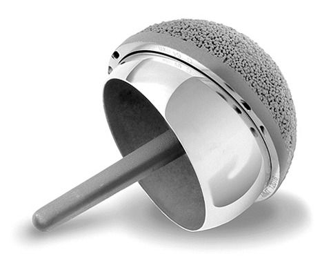 Birmingham Hip Resurfacing