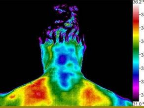 A Chiropractor in Den Haag uses thermography to help chronic pain sufferers