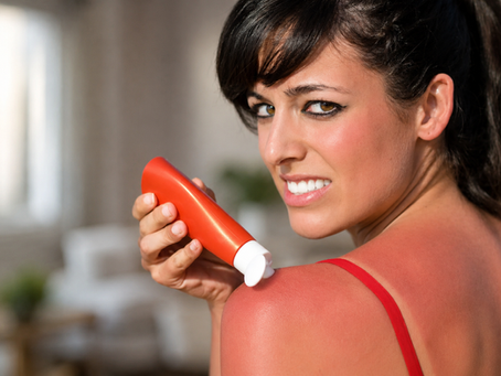 Woman wincing as she applies after-sun lotion to her sunburned shoulder, showing why sunburn recovery needs more than topical care