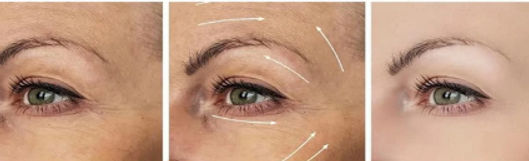 Facial Treat image 1_edited_edited.jpg