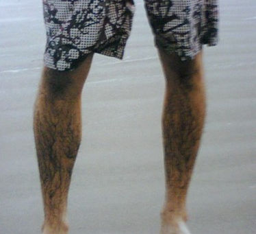 湿度で肌がベタベタ