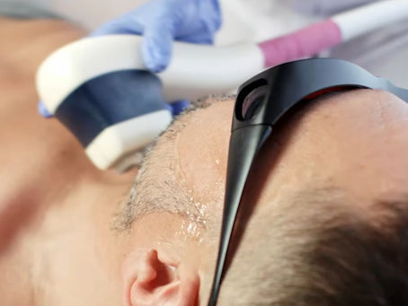 脱毛は10回通えば無くなるの?