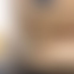 Sigmoidoscopy without Sedation