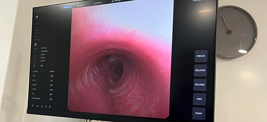 bronchoscopy Woodbridge vets suffolk