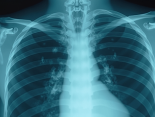 Benefits of Skilled X-Ray Techs in Surgery Centers
