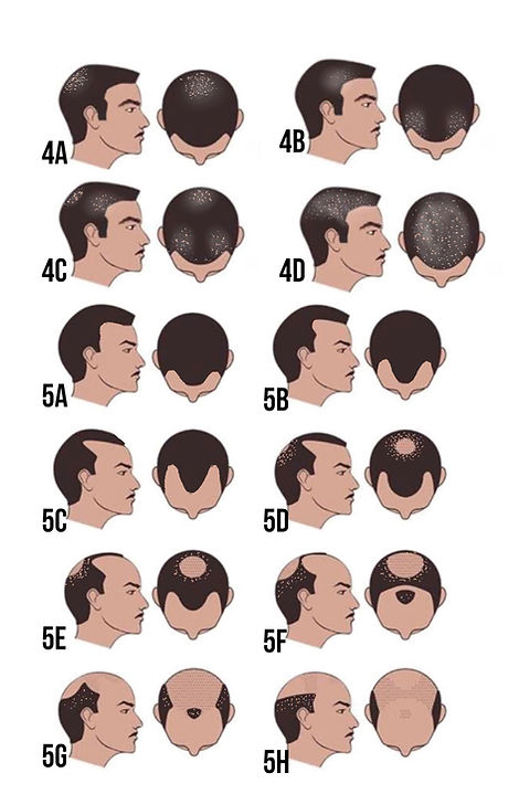 Men scalp references Gulfside Aesthetics