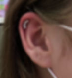 Helix