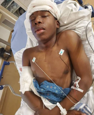 Ralph Yarl, Shot When He Went to the Wrong Address, Released from Hospital. Gunman Identified.