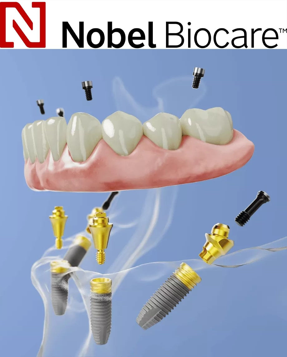 Dental Implant Brands Which Ones Should You Consider?