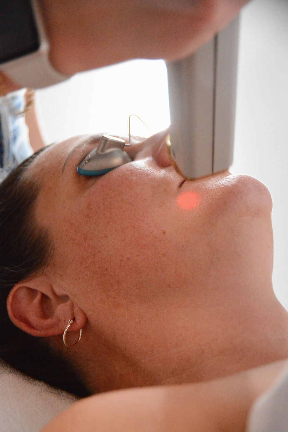 Deep Dermal Tightening