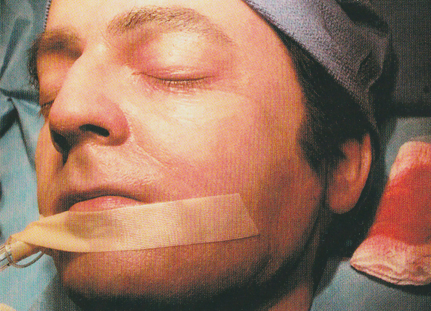 Nip Tuck cheek