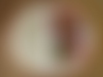 9月15日(金)アレルギーB