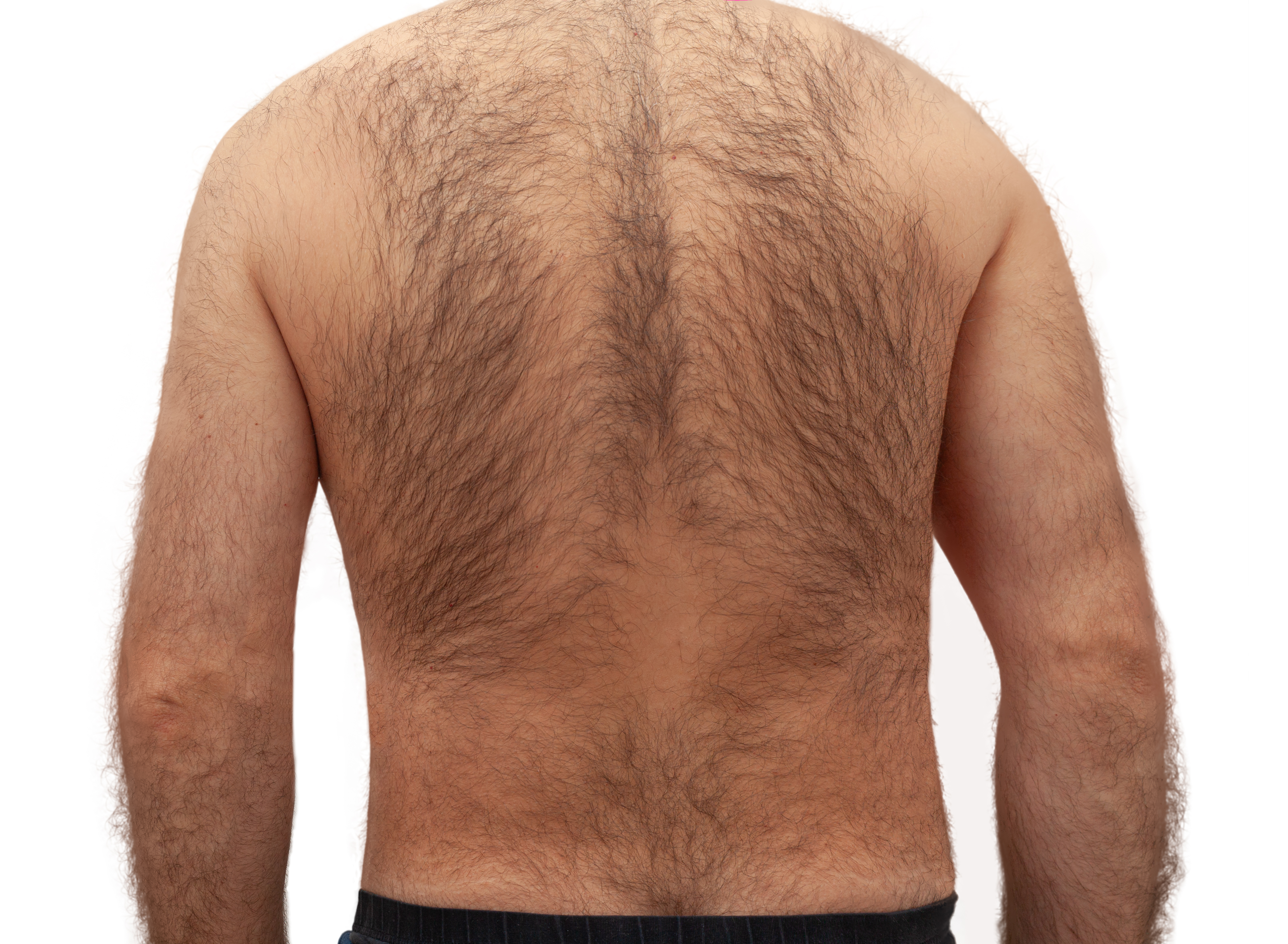 hairy-back-of-a-young-man-2023-11-27-05-20-16-utc.jpg