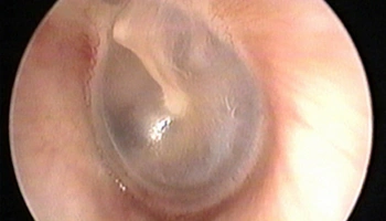 Otomicroscopia