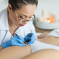 Epilation par electrolyse
