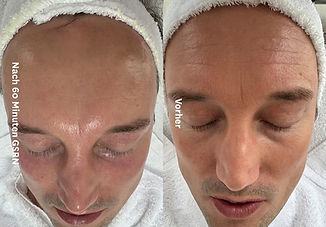 Vorher_Nachher03_Schrift_jpg_edited.jpg