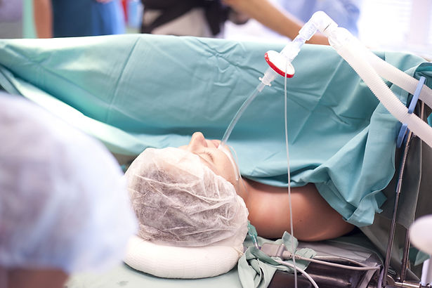 patient intubated.jpg