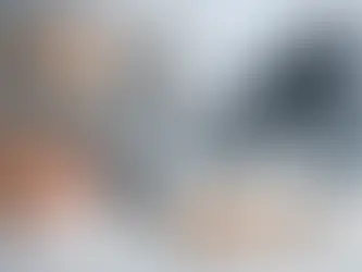 Protez Bakımında Dikkat Edilmesi Gerekenler