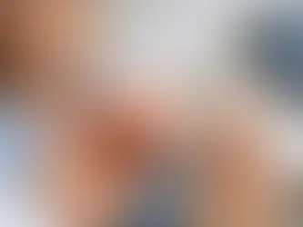 Protez Denemesi Neden Önemlidir? 7 Kritik Nokta