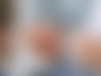 Protez Denemesi Neden Önemlidir? 7 Kritik Nokta