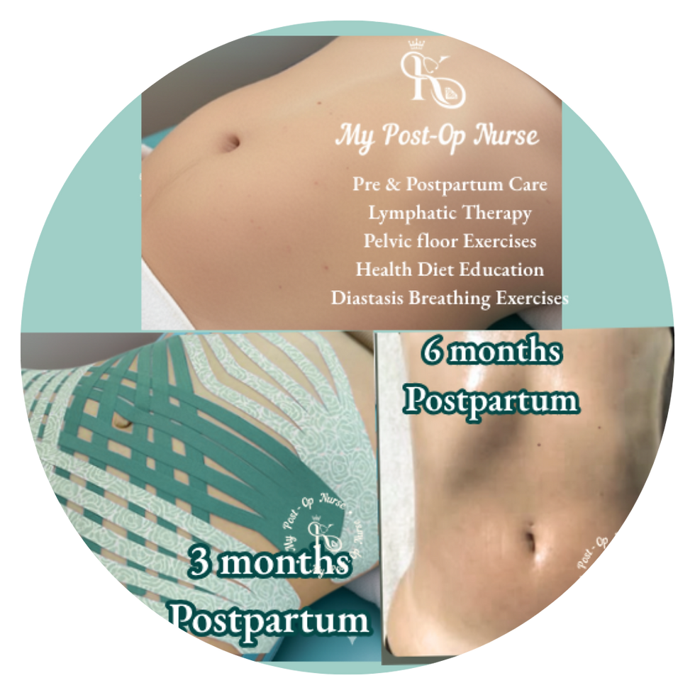 Nurse Kay providing Postpartum massage, pelvic floor therapy and KT postpartum taping in Tampa Bay
