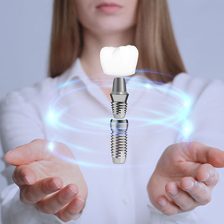 implant couronne dentaire céramique esthétique