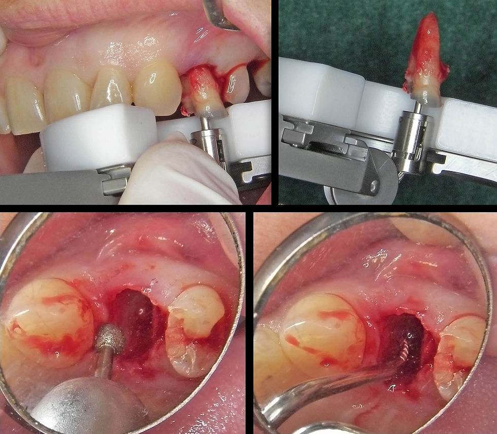 Image courtesy of: Dr. Guillermo Cabanes Gumbau