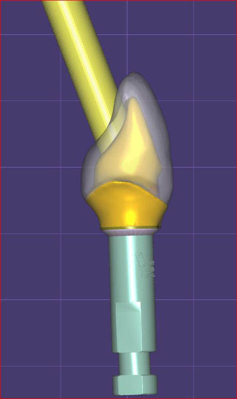 Image courtesy of: Dr. Paolo Nardinocchi