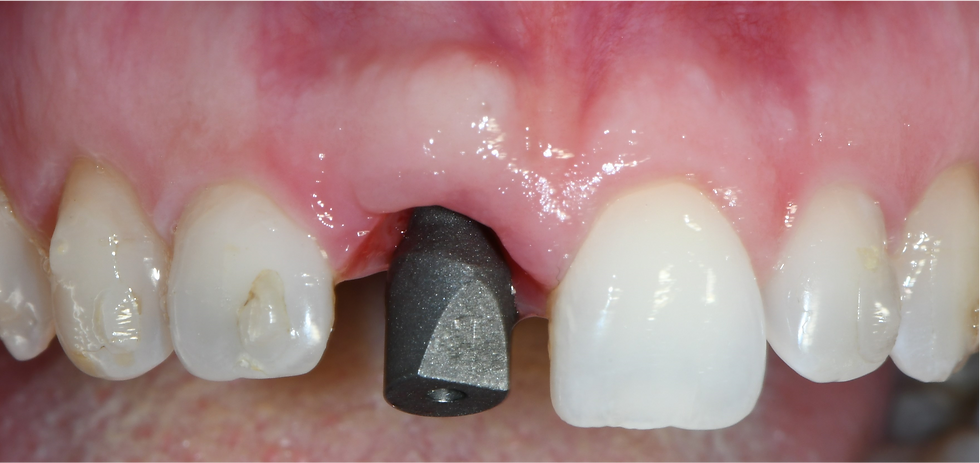 Image courtesy: Dr. Roberto Luongo