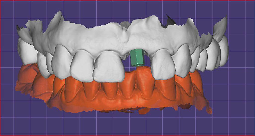 Image courtesy of: Dr. Paolo Nardinocchi