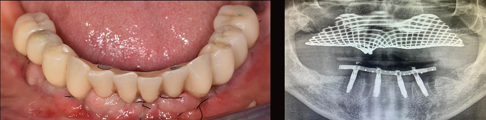 Image courtesy of: Gabriele Gori