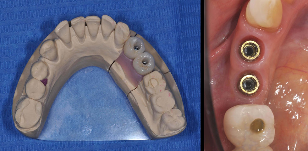 Image courtesy of: Prof. Marco Gargari, Dr. Federico Guzzo