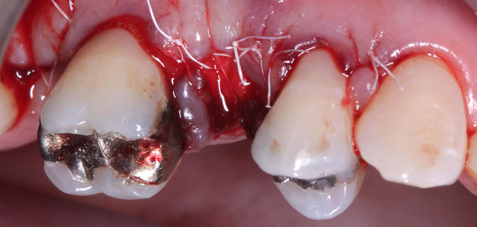 Foto per gentile concessione: Dott. Davide Guglielmi, Dott. Roberto Castellano.