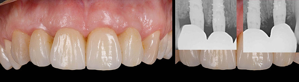 Image courtesy of: Dr. Xavier Vela Nebot, Dr. Xavier RodrÃguez Ciurana