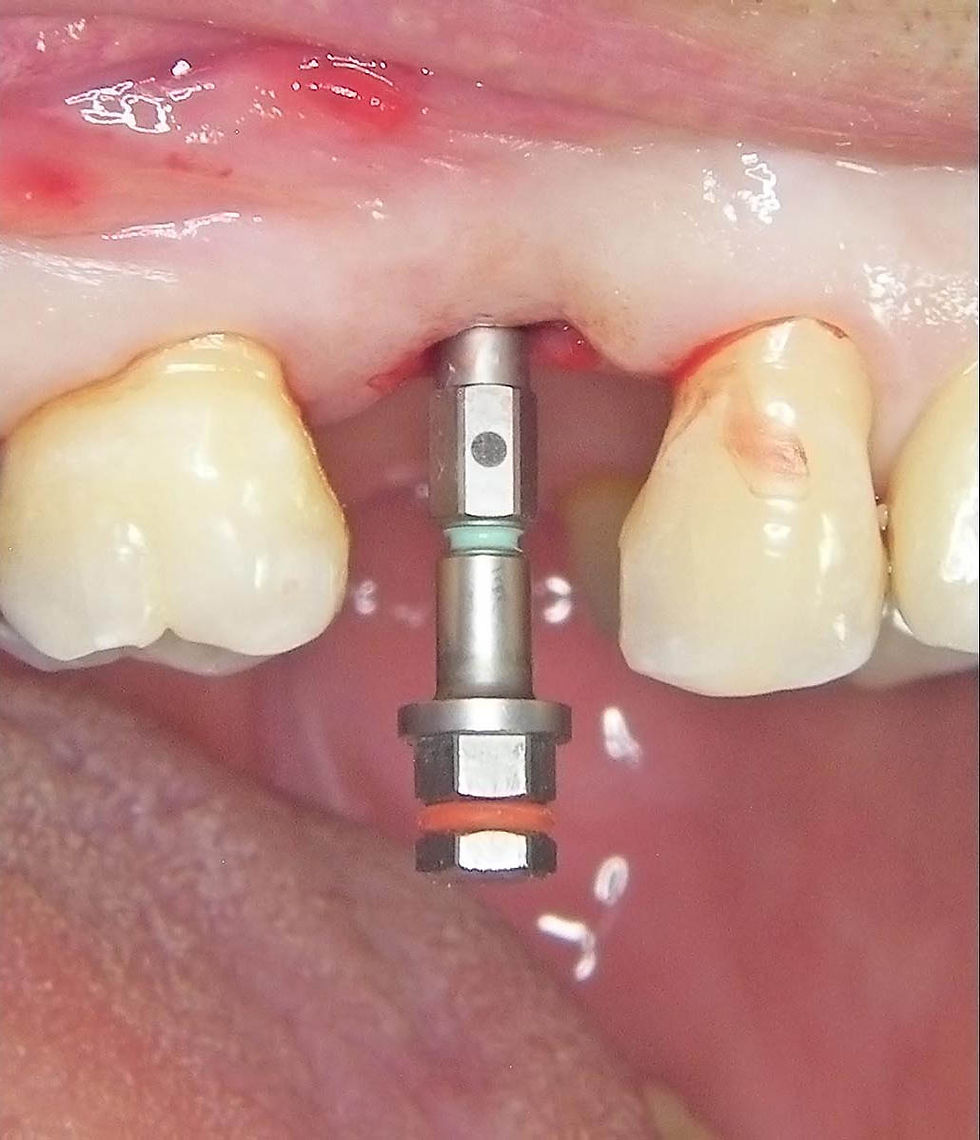 Image courtesy of: Dr. Guillermo Cabanes Gumbau