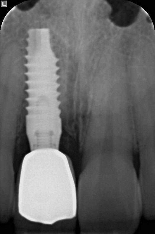 Image courtesy of: Prof. Berta GarcÃa Mira