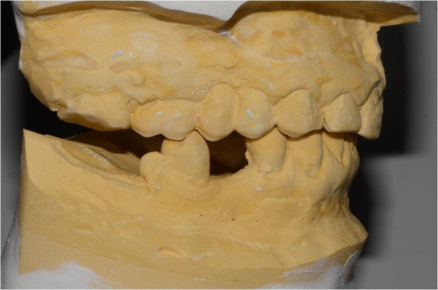 Image courtesy of: Dr. Leonello Biscaro