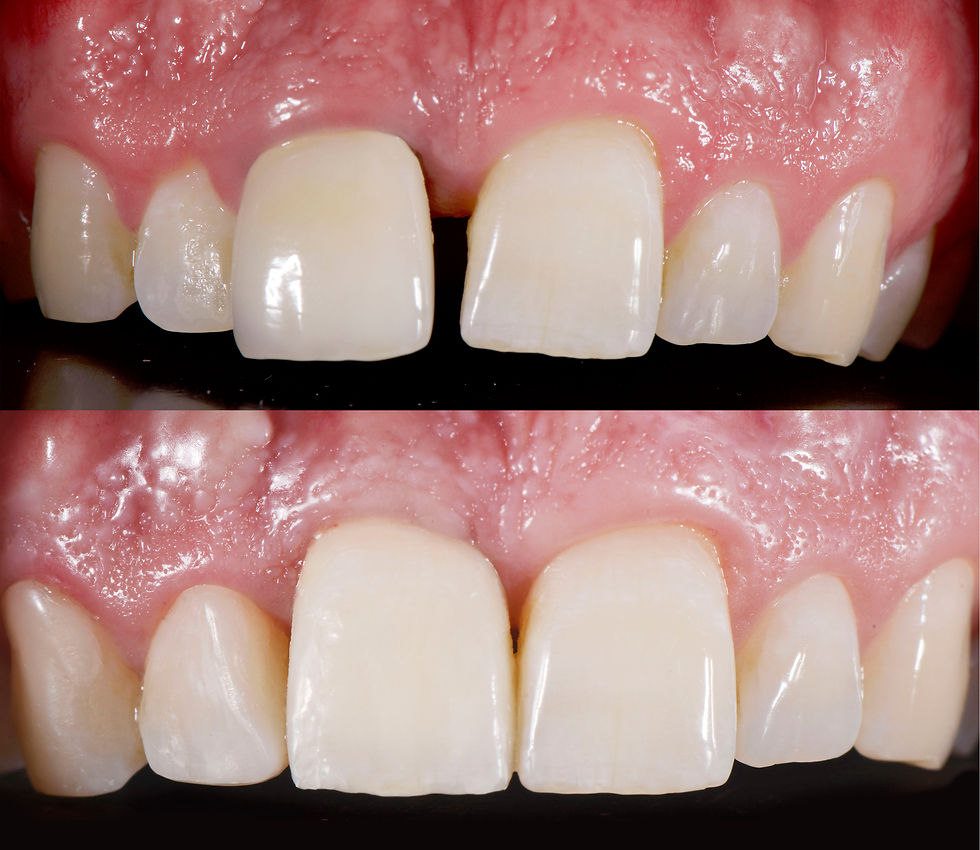 Image courtesy of: dr. Luigi Canullo