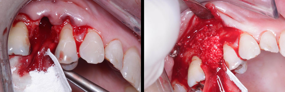 Foto per gentile concessione: Dott. Davide Guglielmi, Dott. Roberto Castellano.