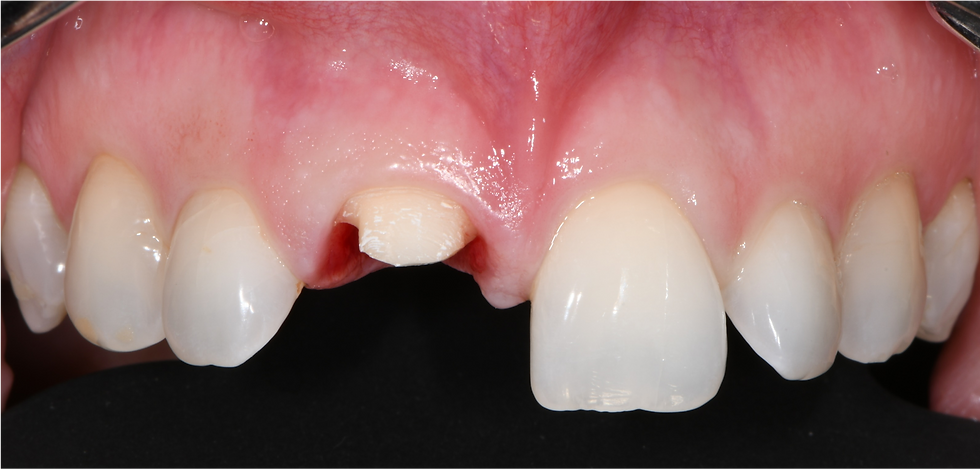 Image courtesy: Dr. Roberto Luongo