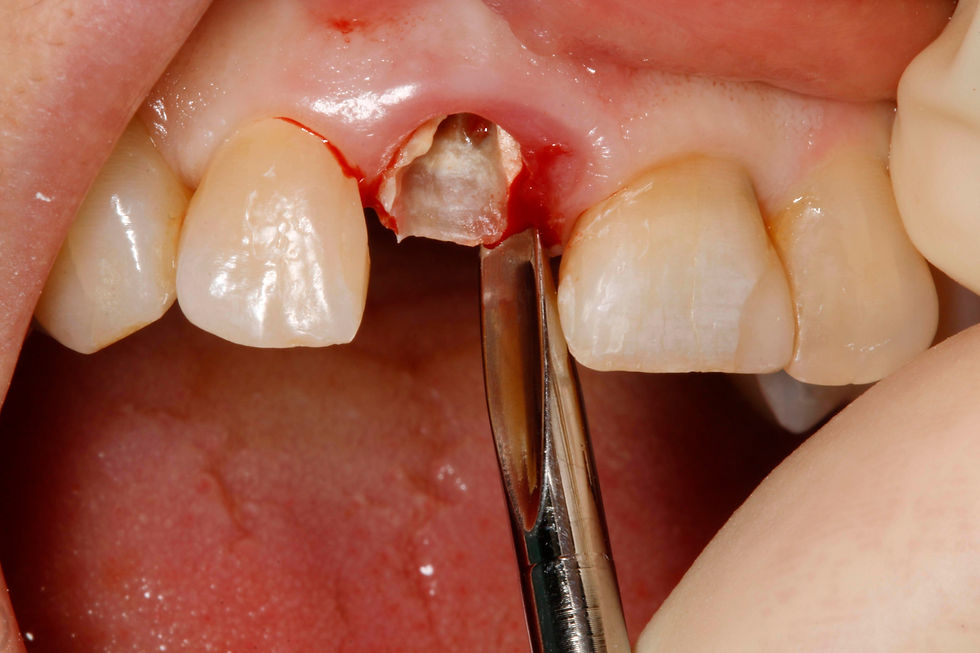 Image courtesy of: Dr. Paolo Nardinocchi