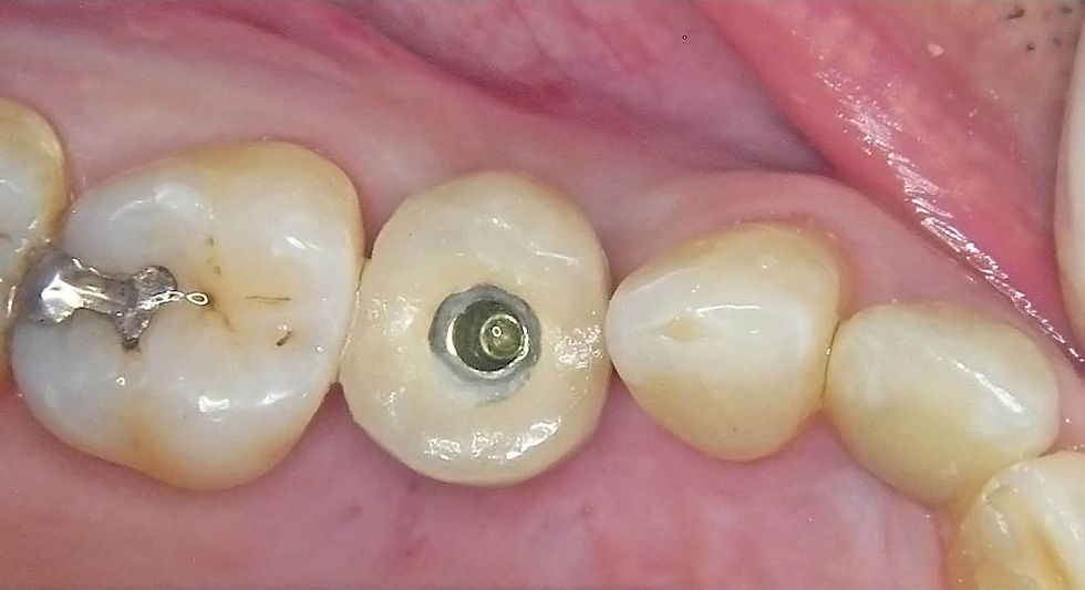 Image courtesy of: Dr. Guillermo Cabanes Gumbau