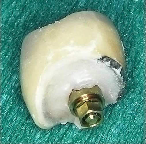 Image courtesy of: Dr. Guillermo Cabanes Gumbau