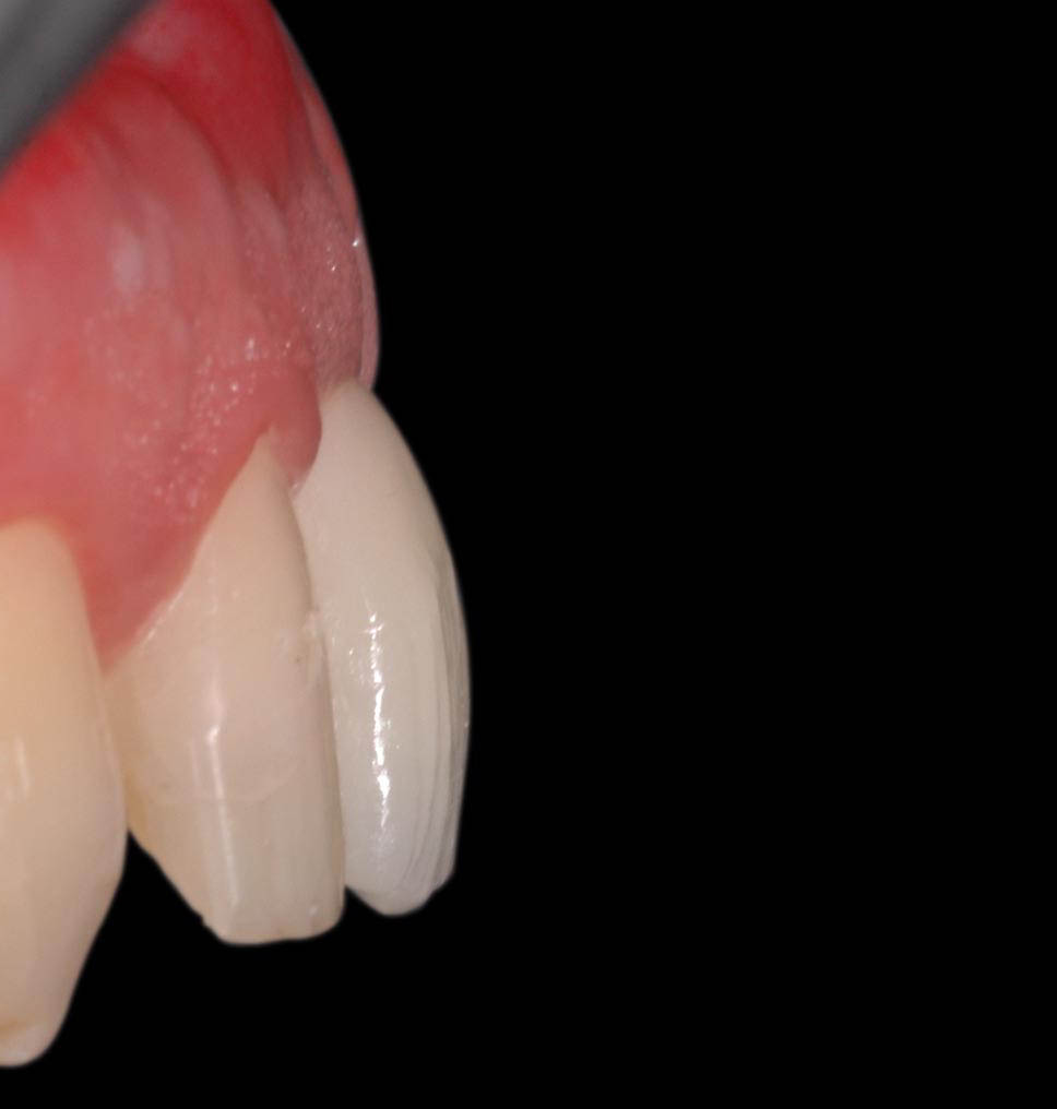 Image courtesy of: Dr. Roberto Luongo