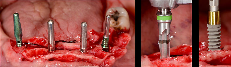 Image courtesy of: Gabriele Gori