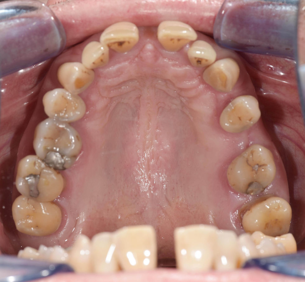 Image courtesy of: Dr. Costantino Vignato, Dr. Giuseppe Vignato