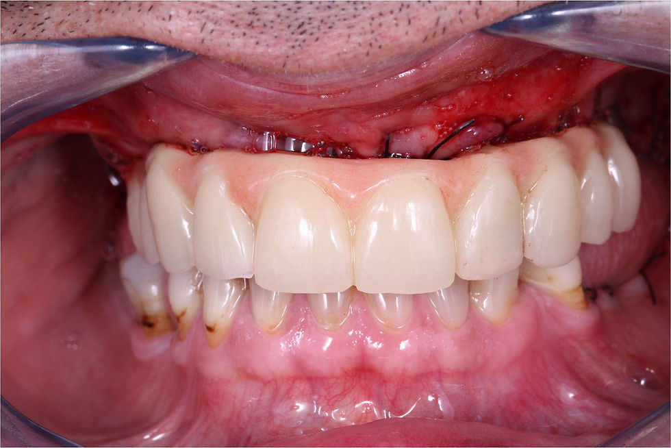 Image courtesy of: Dr. Leonello Biscaro