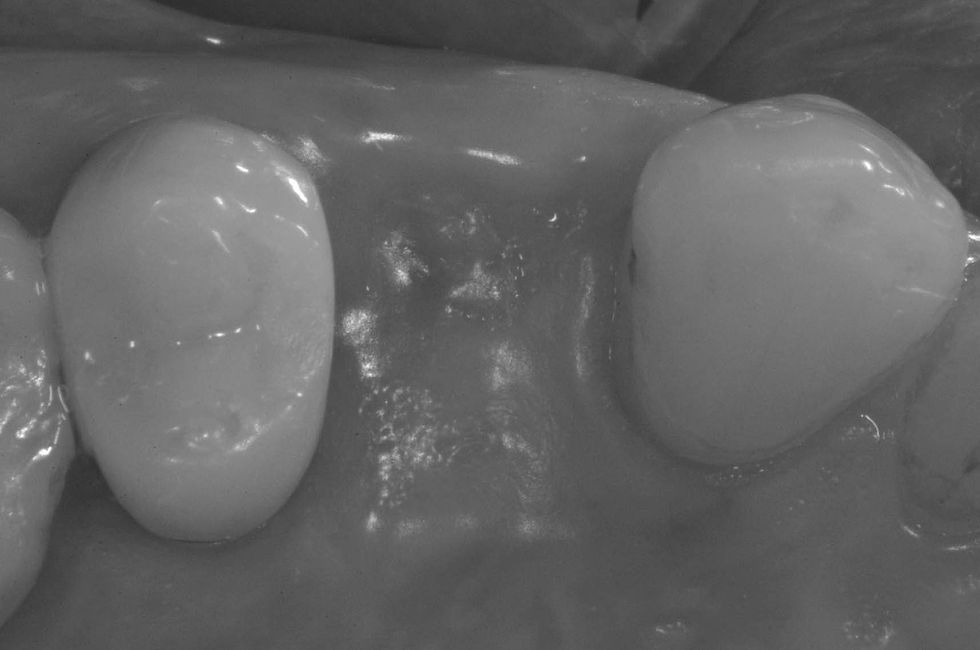 Image courtesy of: Dr. Costantino Vignato, Dr. Giuseppe Vignato.