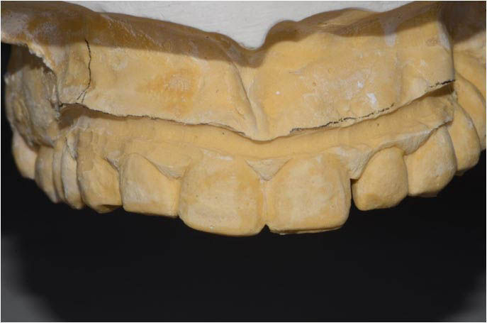 Image courtesy of: Dr. Leonello Biscaro