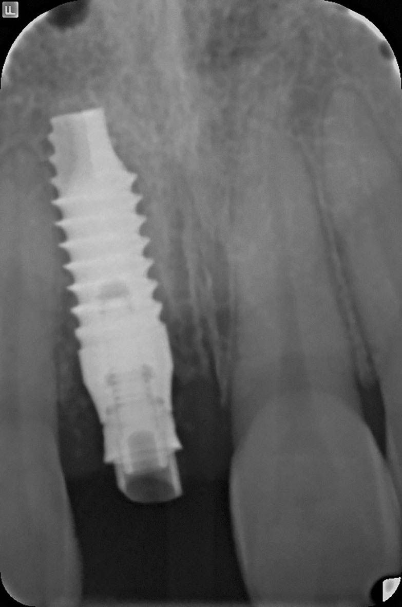 Image courtesy of: Prof. Berta GarcÃa Mira